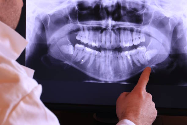 Best Emergency Dental Care for Sports Injuries in Marksville, LA