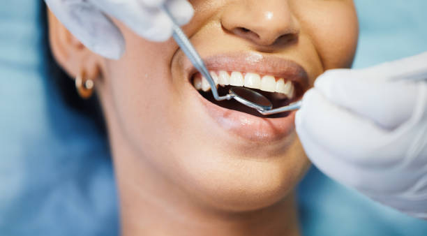 Best Emergency Treatment for Oral Infections in Marksville, LA