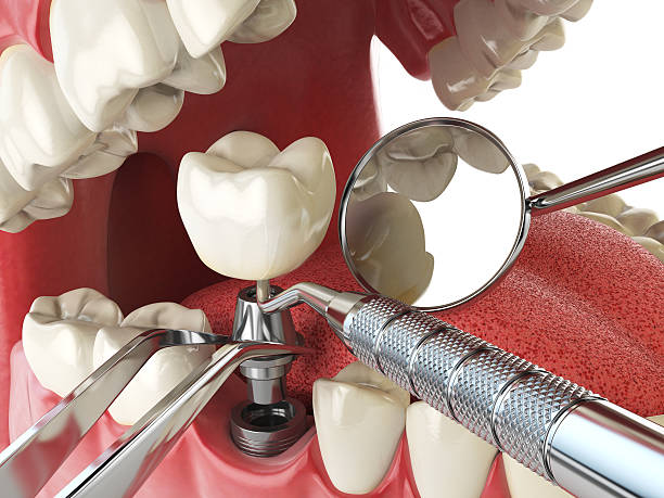 Best Emergency Care for Gum Disease in Marksville, LA